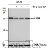 Anti-HSP27 antibody used in Western Blot (WB). GTX112964