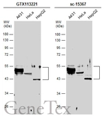 Anti-Cytokeratin 10 antibody used in Western Blot (WB). GTX113221
