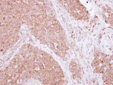 Anti-SIAH1 antibody used in IHC (Paraffin sections) (IHC-P). GTX113268