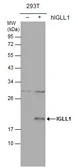 Anti-IGLL1 antibody used in Western Blot (WB). GTX113366