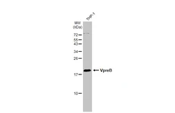 Anti-VpreB antibody [N3C3] used in Western Blot (WB). GTX113368