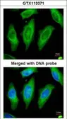 Anti-MST3 antibody [N2C1], Internal used in Immunocytochemistry/ Immunofluorescence (ICC/IF). GTX113371