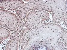 Anti-Aspartoacylase antibody [N1C3-2] used in IHC (Paraffin sections) (IHC-P). GTX113389
