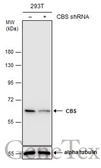 Anti-CBS antibody used in Western Blot (WB). GTX113400