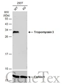 Anti-Tropomyosin 3 antibody [N2C3] used in Western Blot (WB). GTX113568