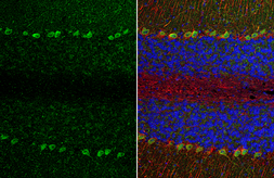Anti-TRPC6 antibody [N1N3] used in IHC (Paraffin sections) (IHC-P). GTX113858