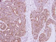 Anti-DcR3 antibody used in IHC (Paraffin sections) (IHC-P). GTX114130
