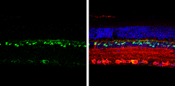 Anti-CHX10 antibody used in IHC (Paraffin sections) (IHC-P). GTX114143