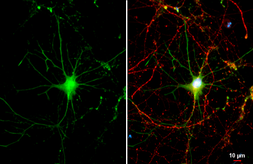 Anti-Renin Receptor antibody [N3C3] used in Immunocytochemistry/ Immunofluorescence (ICC/IF). GTX114169