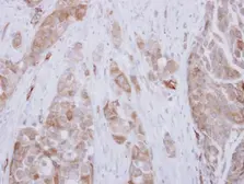 Anti-DPH2 antibody used in IHC (Paraffin sections) (IHC-P). GTX114366