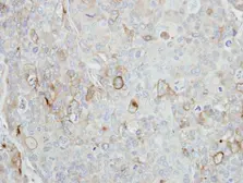 Anti-Stomatin antibody [N2C3] used in IHC (Paraffin sections) (IHC-P). GTX114389
