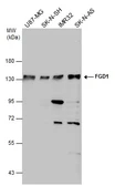 Anti-FGD1 antibody used in Western Blot (WB). GTX114404