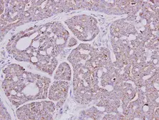Anti-GART antibody [N1N2], N-term used in IHC (Paraffin sections) (IHC-P). GTX114422