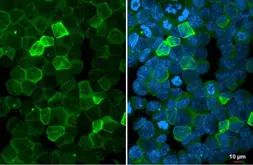 Anti-P2Y2 antibody [N3C3] used in Immunocytochemistry/ Immunofluorescence (ICC/IF). GTX114609