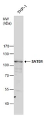 Anti-SATB1 antibody used in Western Blot (WB). GTX114737