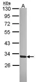 Anti-SGTA antibody [N2C3] used in Western Blot (WB). GTX114755