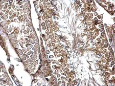 Anti-SH3GL3 antibody used in IHC (Paraffin sections) (IHC-P). GTX114758