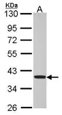 Anti-TSSC1 antibody [N1N3] used in Western Blot (WB). GTX114857