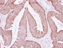 Anti-ATP synthase B1 antibody [N1C3] used in IHC (Paraffin sections) (IHC-P). GTX114970