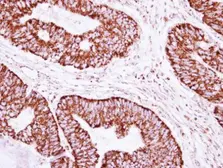 Anti-CLPP antibody [N2C3] used in IHC (Paraffin sections) (IHC-P). GTX115070