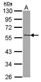 Anti-DLK1 antibody used in Western Blot (WB). GTX115136