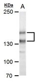 Anti-SPAG5 antibody used in Western Blot (WB). GTX115449