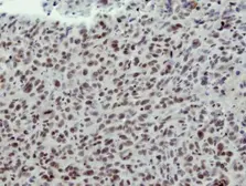 Anti-CLP1 antibody [N3C3] used in IHC (Paraffin sections) (IHC-P). GTX115518