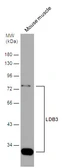 Anti-LDB3 antibody used in Western Blot (WB). GTX115593