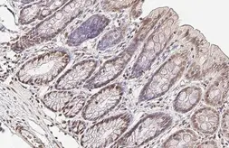 Anti-U2AF65 antibody [C1C3] used in IHC (Paraffin sections) (IHC-P). GTX115622