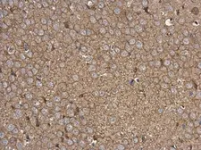 Anti-Rabphilin 3A antibody used in IHC (Paraffin sections) (IHC-P). GTX115646
