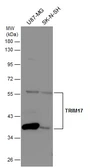 Anti-TRIM17 antibody [N1N3] used in Western Blot (WB). GTX116138