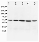 Anti-MTCO1 antibody used in Western Blot (WB). GTX11619