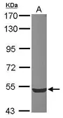 Anti-ZWILCH antibody used in Western Blot (WB). GTX116281