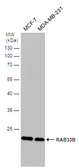 Anti-RAB33B antibody [N2C3] used in Western Blot (WB). GTX116390