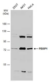 Anti-PBXIP1 antibody used in Western Blot (WB). GTX116669