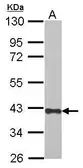 Anti-CREBZF antibody used in Western Blot (WB). GTX116707
