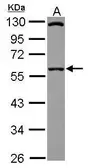 Anti-SIL1 antibody [N1C2] used in Western Blot (WB). GTX116756