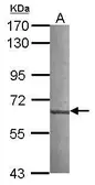 Anti-CML66 antibody [N1N3] used in Western Blot (WB). GTX117006
