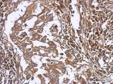 Anti-LAX1 antibody used in IHC (Paraffin sections) (IHC-P). GTX117186