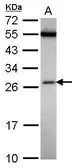 Anti-FAAP24 antibody [N1C3] used in Western Blot (WB). GTX117277