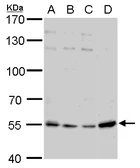 Anti-Visfatin antibody [N1N3] used in Western Blot (WB). GTX117444