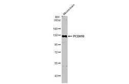 Anti-PCDH10 antibody [N1N2], N-term used in Western Blot (WB). GTX117863