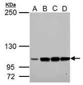 Anti-LRIG3 antibody used in Western Blot (WB). GTX117929