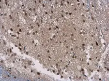 Anti-SIRT7 antibody [N2C3] used in IHC (Paraffin sections) (IHC-P). GTX117939