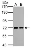 Anti-Caper antibody used in Western Blot (WB). GTX118112