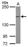 Anti-MLH3 antibody [N1N2], N-term used in Western Blot (WB). GTX118151