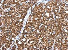 Anti-CRYZ antibody [N1C1] used in IHC (Paraffin sections) (IHC-P). GTX118270