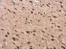 Anti-Tub antibody used in IHC (Paraffin sections) (IHC-P). GTX118348