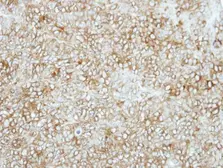 Anti-SEMA6C antibody [N1N2], N-term used in IHC (Paraffin sections) (IHC-P). GTX118489