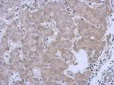 Anti-MRPL10 antibody [N2C3] used in IHC (Paraffin sections) (IHC-P). GTX118663